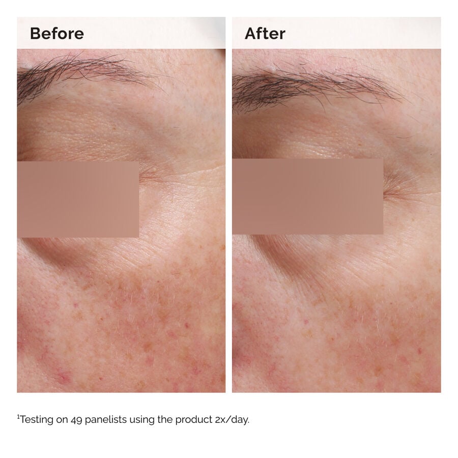 niacinamide-5-face-and-body-emulsion-c8 2024-08-23-ORD-Nia-5pct-Face-Body-B-A-Elasticity-Global-02-1x1.jpg