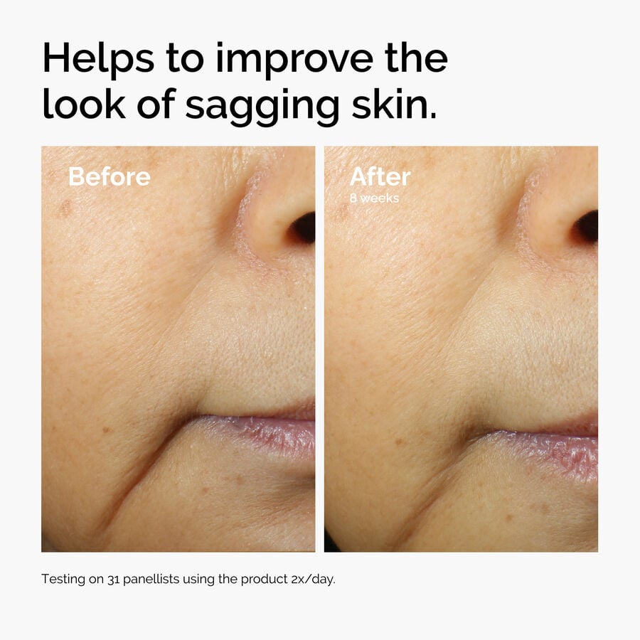 caffeine-3-escin-1-face-serum-z0 ord-caffeine-3pct-escin-1pct-face-serum-before-after-sagging.jpg