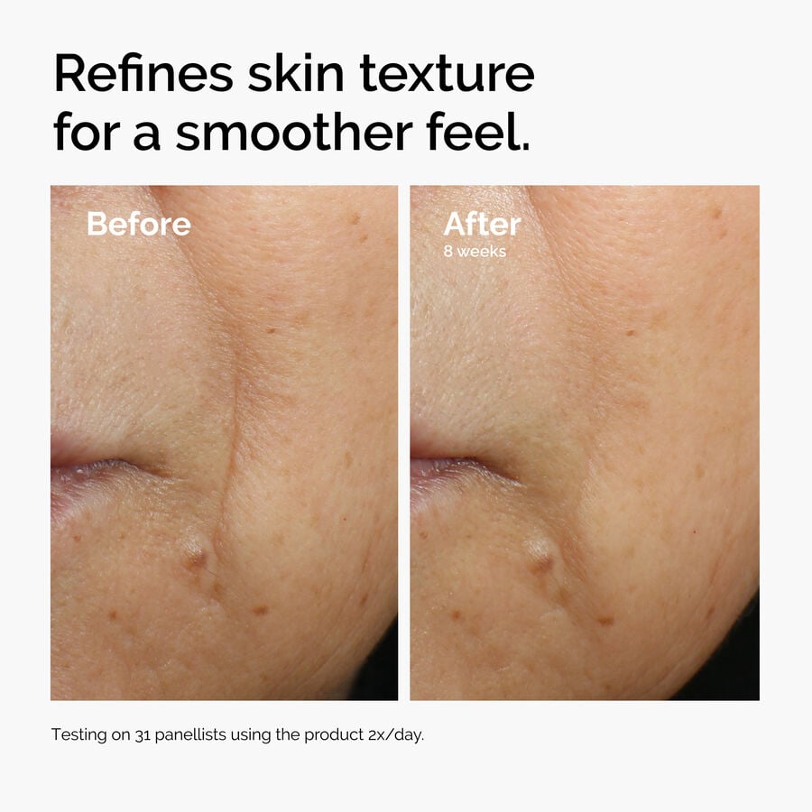 caffeine-3-escin-1-face-serum-z0 ord-caffeine-3pct-escin-1pct-face-serum-before-after-texture.jpg
