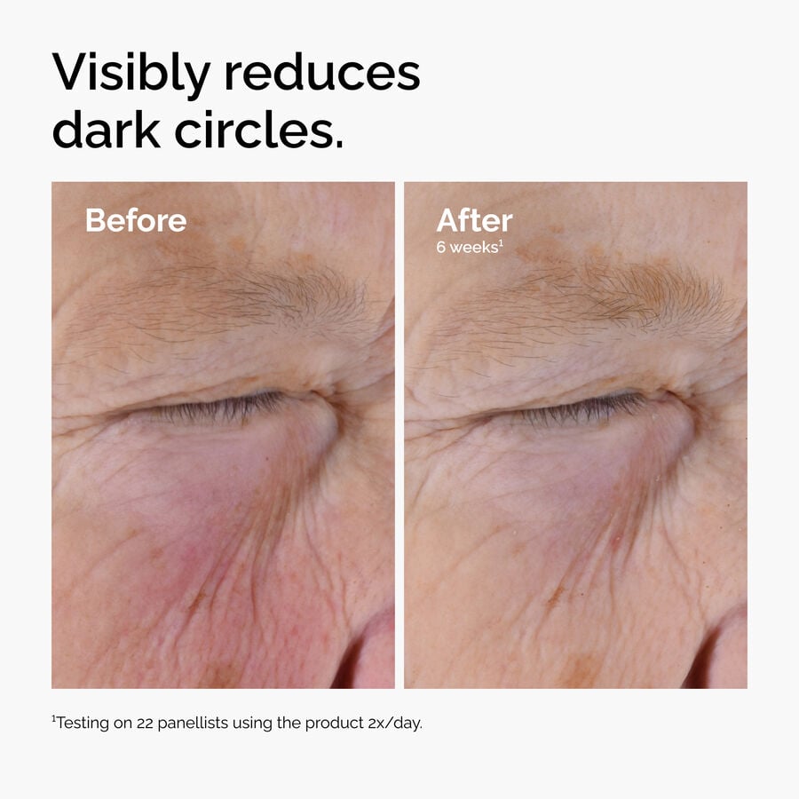 caffeine-solution-5-egcg-eye-serum-v5 ord-caffeine-solution-egcg-dark-circles-before-after.jpg
