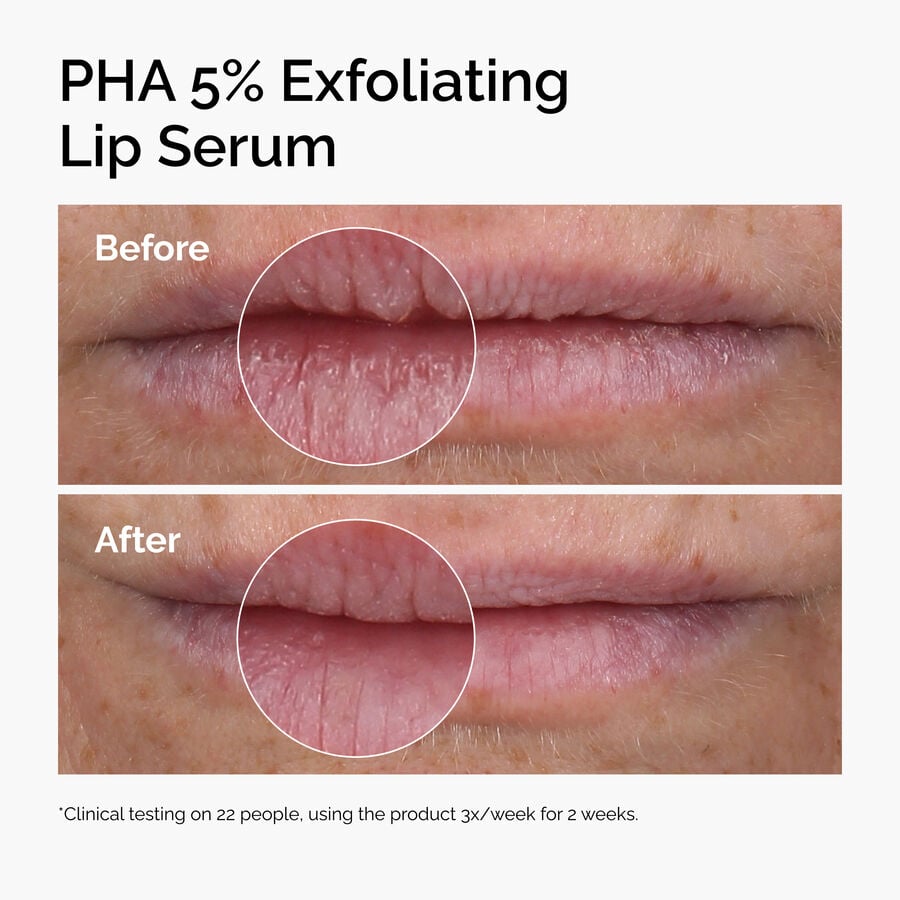 pha-5-exfoliating-lip-serum-u1 ord-pha-5pct-lip-exfoliating-serum-before-after.jpg
