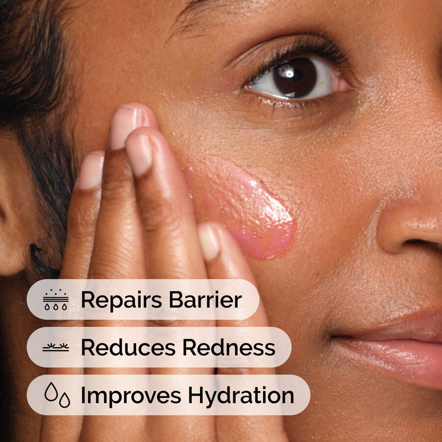 soothing-and-barrier-support-serum-j8 ord-soothing-barrier-support-serum-model-application-with-benefits.jpg
